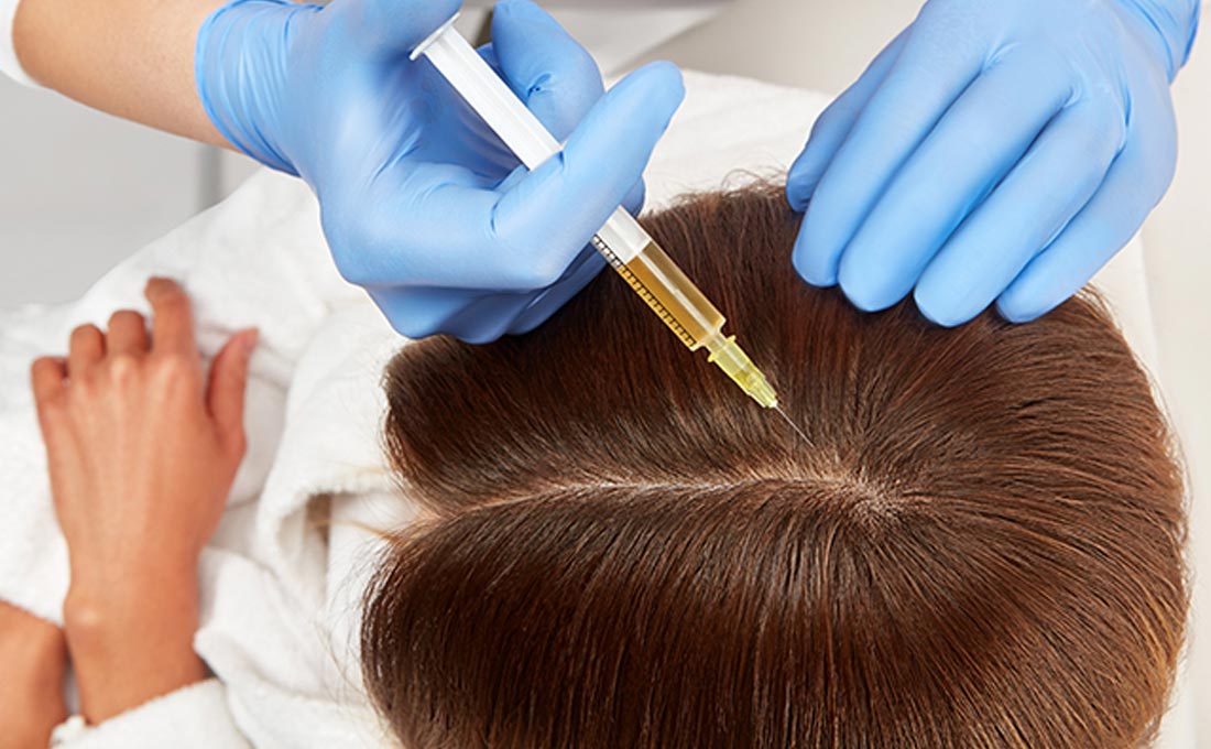 Hair Mesotherapy What Is It  MyCapil 