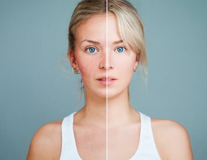 A woman with two different colors of skin