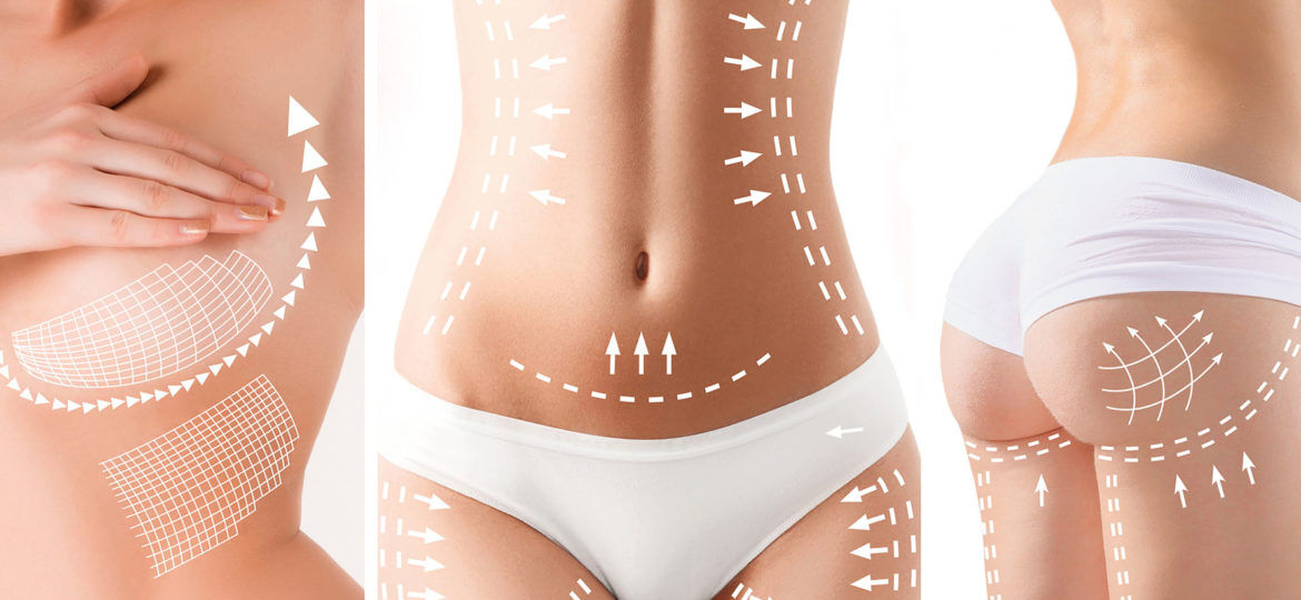 A woman in white underwear with lines drawn on them.