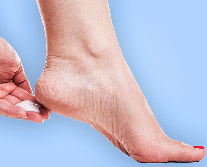 How to Repair Dry And Cracked Heels